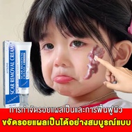 Breylee ของแท้ ลบรอยแผลเป็น ครีมทาแผลเป็น ครีมลดแผลเป็น scar removal cream ยาทาแผลคีลอยด์ ครีมทาแผลผ่าคลอด ลดแผลไฟไหม้ แผลน้ำร้อนลวก แผลผ่าตัดเป