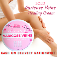 VARICOSE VEINS HEALING CREAM | VARICOSE CREAM | VARICOSE VEINS REMOVER | VARICOSE CREAM ORIGINAL