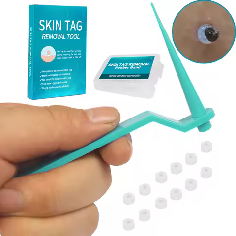 Micro skin tag remover Rubber bands for micro Skin tag wart Remove Acne remover Treatments Face Skin