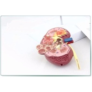 Kidney Stones Disease Model Urology Nephron Renal Glomerulus Anatomical Renal Anatomy Model Medical