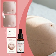 WIIEEY Stretch Mark Oil 30ml Stretch Mark Prevention Oil Mencegah Renggangan Kulit Ibu Hamil
