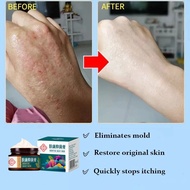 Eczema cream Psoriasis cream Itchy Skin Antifungal Cream Itchy Gap Herbal