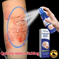 Ubat gatal kulit Ubat kurap Obat gatal Psoriasis Relief Spray Kulit Itchy Skin Relief Anti Itch Topi