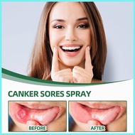 ❦ ⚛ ௹ 30ml sore throat spray/deep throat/difflam throat spray/moreishi throat spray/mouth ulcers