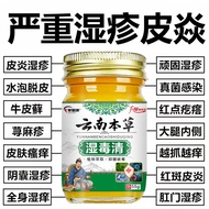 Yunnnan Eczema Cream Stubborn Eczema Piyan Hill Rash Eczema Eczema Eczema Eczema Blister Blister Ski
