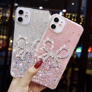 Bowknot Cases For Xiaomi Mi 10T 10TPro 11Lite 11T 11TPro 12T 12TPro 13T 13TPro 14T 14TPro POCO X3 X3