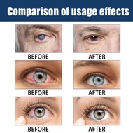 Dry Eye Therapy Eye Drops Anti Dryness Relief Discomfort Fatigue Eye Drops for Women Men Eye Care Dr
