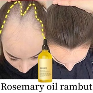 Rosemary oil for hair growth rosemary oil original Hair loss treatment hair tonic growth rosemary oi
