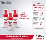 [ส่งฟรี] [แพ็ค 3] ACNE-AID FOAMING FACE WASH OIL CONTROL 100 ML เซ็ตแอคเน่-เอด ออยคอนโทรลโฟม