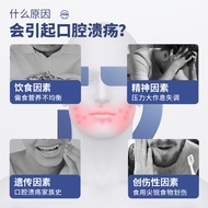 Dr. Rotus Oral Ulcer Gel Spray Oral Ulcer Repair Liquid Medical Dressing Reduced Ulcer Area, etc.