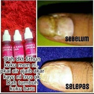 AIR AJAIB AKAR KAYU AMIRNA