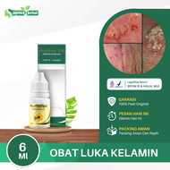 Obat Luka Pada Kelamin Pria Penis Lecet Luka Penis Kulit Penis Perih Luka Melepuh Buah Zakar Luka Ga