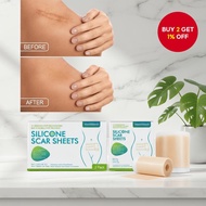 Hypoallergenic Silicone Scar Sheets for Post-Surgery, C-Section, and Burn Scar Treatment, 4x150cm