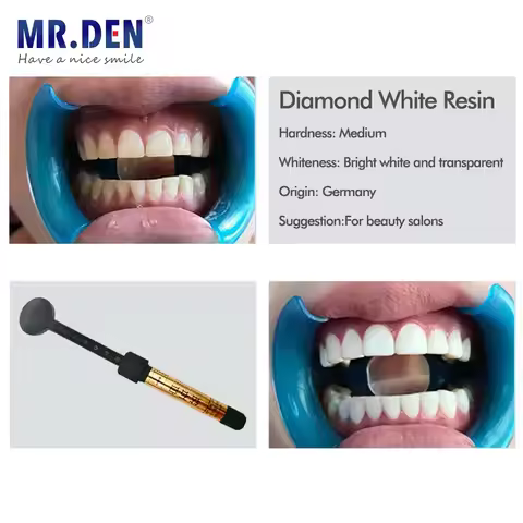 Nano enamel veneer material teeth whitening light curing resin Ivoclar vivadent IPS Empress Direct B