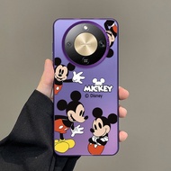 Honor X9d 5G HONOR X9d Premium Colored Silver Case Shockproof Cover Mickey Mouse Matte Feeling Casin
