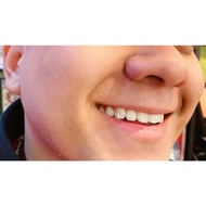 Diamond Tooth Coating Motif Diamond