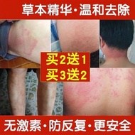 Dermatitis Eczema Itching Cream Anti-Inflammatory Anti-Itching Red Dot Skin Irritability Urticaria W