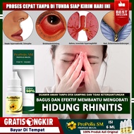 Obat Rhinitis Rhinitis Alergi Rhinitis Alergi Dingin Herbal Rhinitis Rhinitis Alergi Debu Peradangan