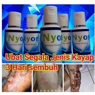 Ubat kayap , Ubat kayap api , Ubat kayap ular & ubat semua jenis kayap, 3 hari sembuh