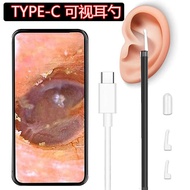 Type-c HD Visual Ear Spoon Endoscope Ear Cleaner Ear Picking Mirror Ear Picking Spoon Ear Picking To