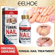 Eelhoe Ringworm Of The Nails Repair Nail Care Solution Foot Nail Thickening In Armour Nail Concavo-C