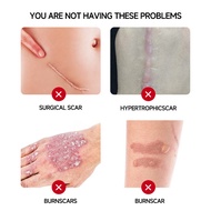 All English Scar Cream 0g Remove Repair Soothing Skin Surgery Increase Postpartum Old Scar Cream OEM