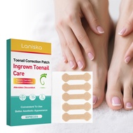 Ingrown Toenail Treatment, 60Pcs Breathable Ingrown Toenail Strips,Painless Ingrown Toenail Tool, Pr