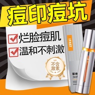 Acne removal cream to remove acne marks acne pit acne acne acne acne fat particles acne cream,祛痘膏祛痘印