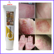 Skin Herbal Cream For Skin Allergies Antibacterial & Antifungal  Skin Herbal Psoriasis Dermatitis Ec