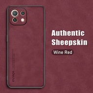 Jingsanc Ốp Da Cho Xiaomi Mi 11 Lite/Mi 11 Lite 5G/Mi 11 Lite 5G NE Ốp Điện Thoại TPU Mềm Silicon Da