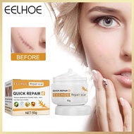 Eelhoe Surgical Scar Repair Cream Effective Remover Pimples Acne Scar Removal Face Cream Promote Cel