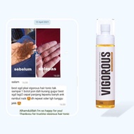 ✅ [Good price] Vigorous Hair Vitamin Tonic By Bellakhan | Vigorous Hair Growth - Thickening,Black an