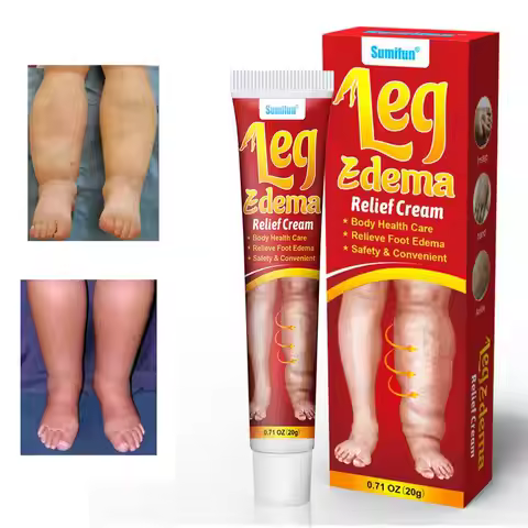 200g Muscle Massage Cream Relieve Foot Edema Leg Swelling Anti Edema Ointment For Circulation Relief