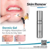 Skin Renew Dermis Gel