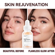 Ready Stock Quick Shipping Essence Lactic Acid Remove Blackheads Lactic acidessence Rejuvenating Moi