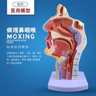 Head Anatomy Model Oral Nasal Throat Anatomy Inner Vascular Neural Model Human Nasal Oral Throat Ana