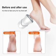 日本暢銷 - 電動吸塵磨腳器 家用多功能修腳去死皮去老繭手足護理器