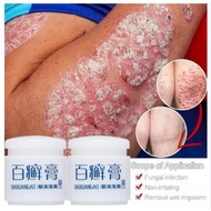 BaiXuanGao Psoriasis Eczema Cream Psoriasis Herbal Miracle Cream Acne Keratosis Rashes Fungal Infect