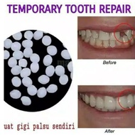 Temporary Tooth Repair Kit / Denture Adhesive / Tooth Glue / Fake Teeth