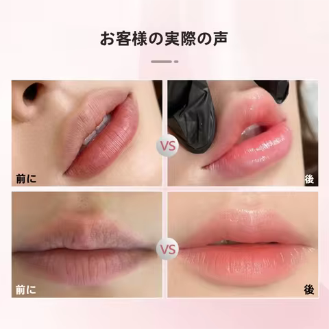 Sober Skin BB lip lip treatment: permanent makeup, melanin removal, pink and healthy lip recovery, S
