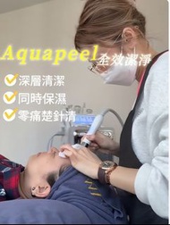 Aqua Peel