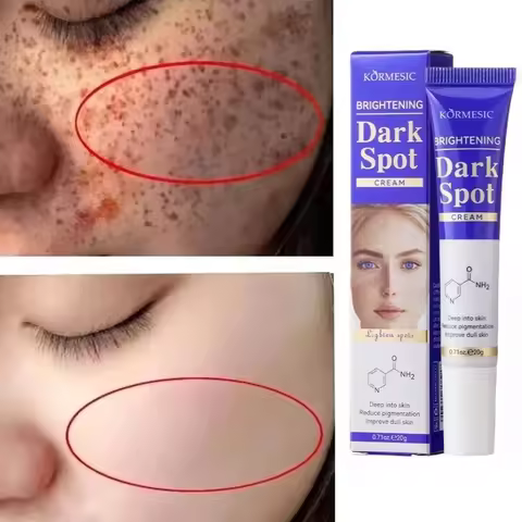 Amino Acid Freckle Whitening Cream Fade Pigmentation Melasma Dark Spots Corrector Repair Cream Korea