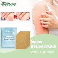 EELHOE Eczema Treatment Patch Cure Psoriasis Hand Tinea Inhibit Dermatitis Fungus Antibacterial Herb