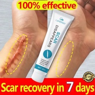☑◎  Fast Recovery Scar Cream Stretch Marks Repair Burn Surgery Skin Treat  Keloids Acne Pox Prints Removal Ointment Smooth Skin Gel