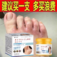 Japan Imported Foot Cream Dedicated Anti-itch Cream Fungus Infection Water Peeling Bad Foot Small Bl