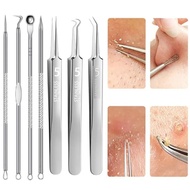 Acne Treatment Kit – Blackhead Removal Tool, Needle, Tweezers For Four Seasons Use