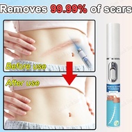 Remove scars in 7 days Scar removal laser pen scar removal c section scar acne scar removal acne las