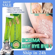 Eczema Cream Psoriasis Ointment Antifungal Cream Anti Bacteria, Anti Viral, Relief Itchy/Redness