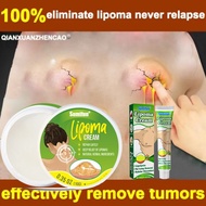 UNINICE 100% Efektif Lipoma Removal Cream Cellulite Salep untuk kulit yang sempurna mencapai kulit y