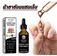 Buy 1 Get 1 Free 100% genuine eelhoe nail art fungus repair essence improve effective nail damage ca